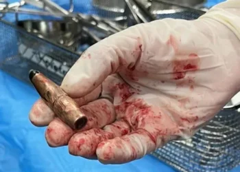 Amerikalı Cerrahlar: “Gazze’de Ölü Çocuklar İçin Ayrı Bir Alan Var”